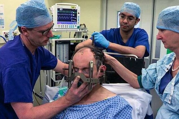 Three doctors adjusting a brace around a patient's head